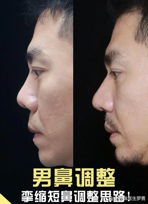 男人鼻子露骨面相-男人气质显于鼻