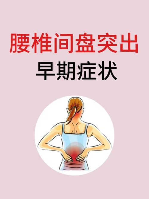 腰间盘突出自查_1