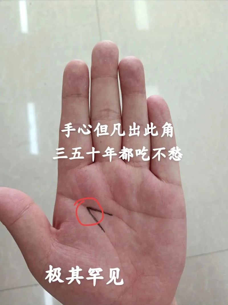 小鱼际有横纹手相_2