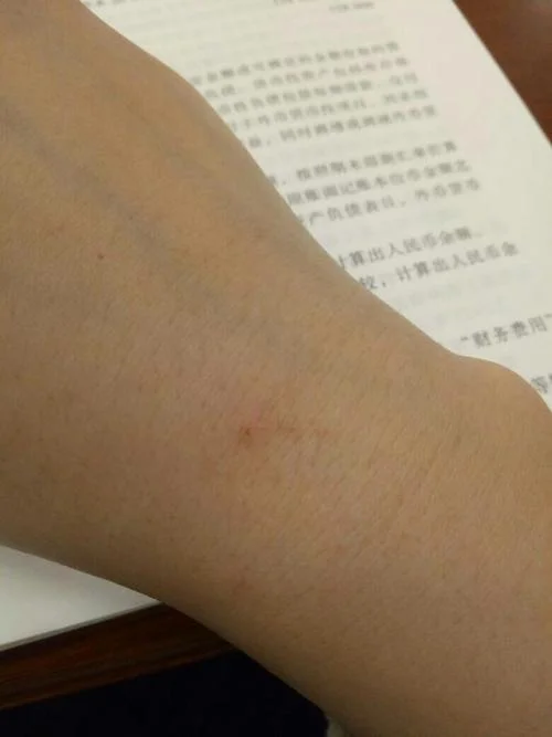 做梦梦到抓鸡被鸡抓伤_2