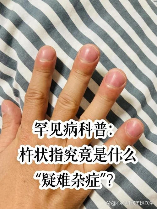 手指叫什么指_1