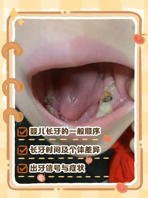 小孩出生就有牙齿算命-小孩生牙算命