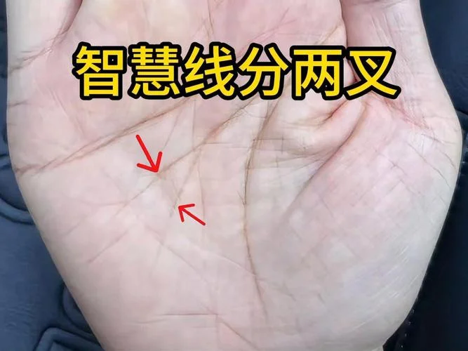 手相叉叉纹_2
