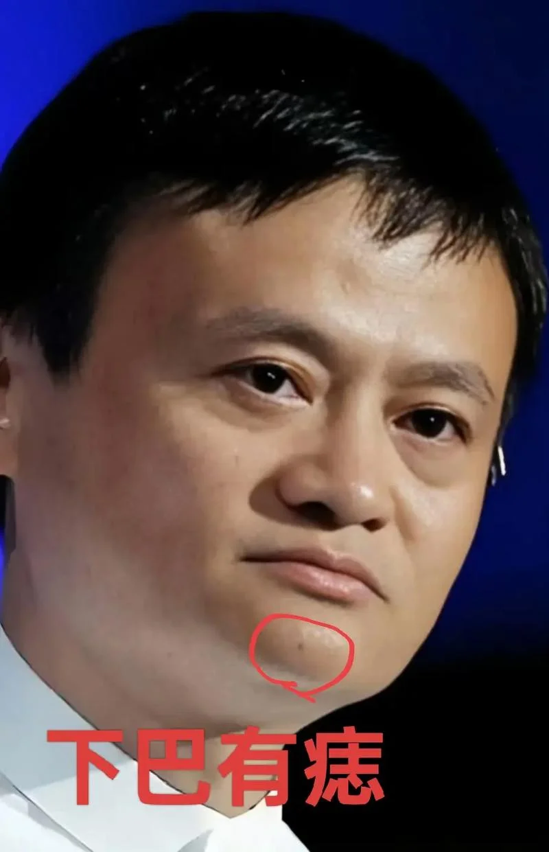 下巴长痣的面相图_2