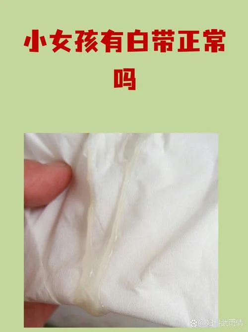 白带臭怎么办-白带臭异味处理