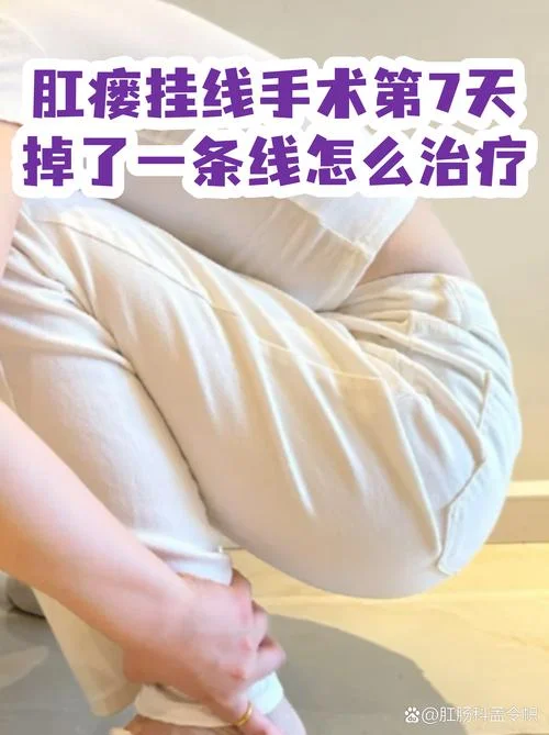 肛瘘挂线皮筋脱落原理_1