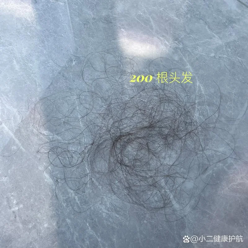 梦见自己洗头掉了好多头发_1