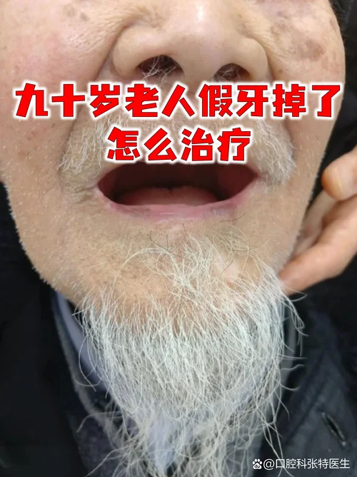 做梦梦见假牙掉了-梦见假牙脱落