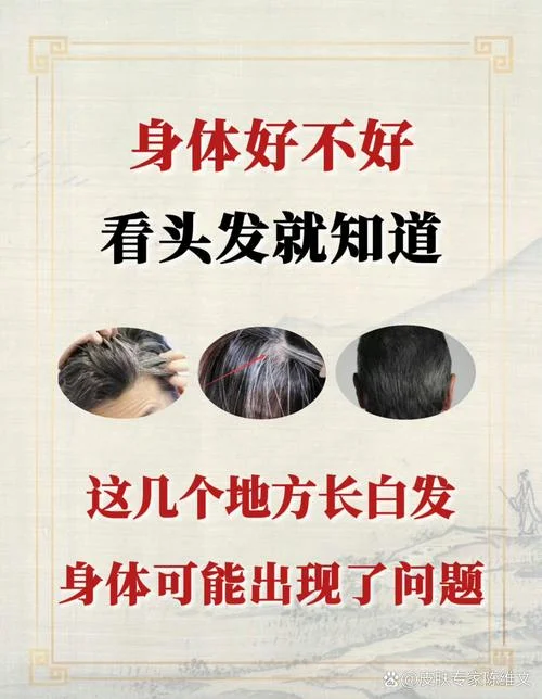 梦见自己长白发还掉发-梦长白发又脱发