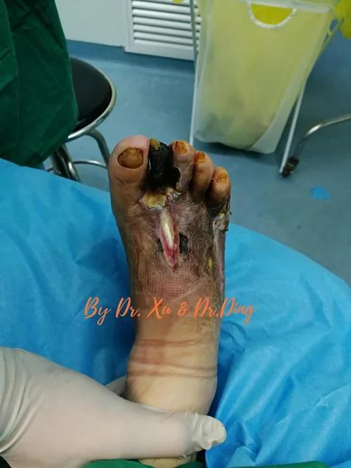 梦到腿断了露出骨头_2