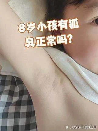 狐臭多大年龄会没有了-狐臭多大年龄会消失？