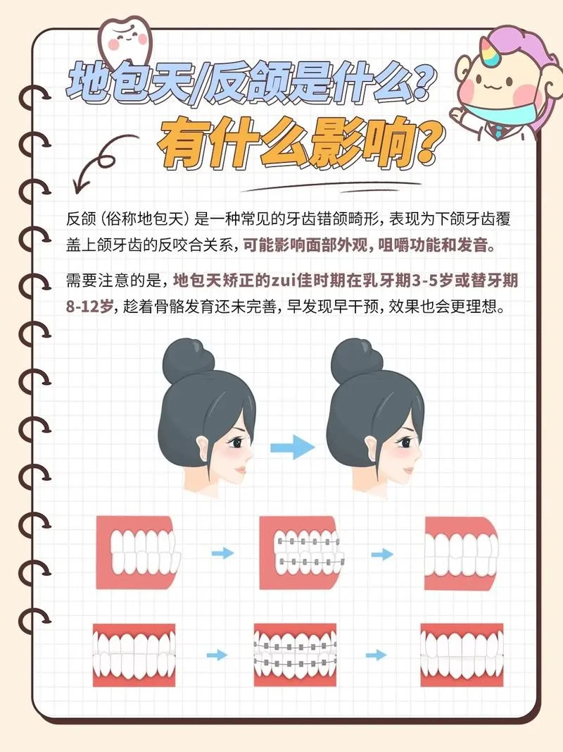 牙突出自我矫正方法_1
