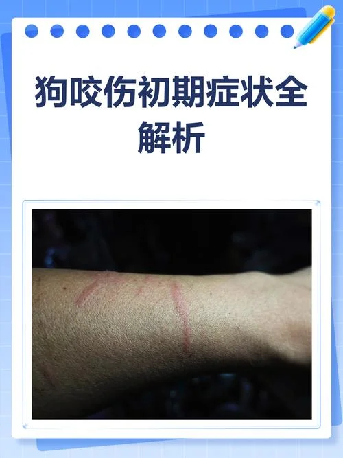 梦见被大白狗咬-梦见被大白狗咬