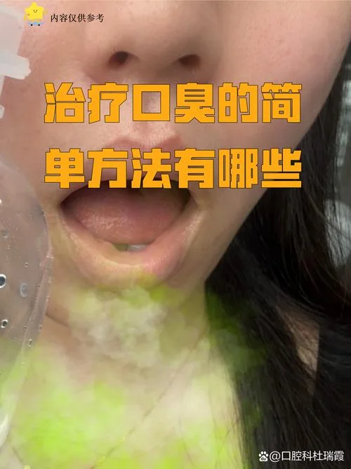 口气清新剂怎么用-口气清新剂使用教程