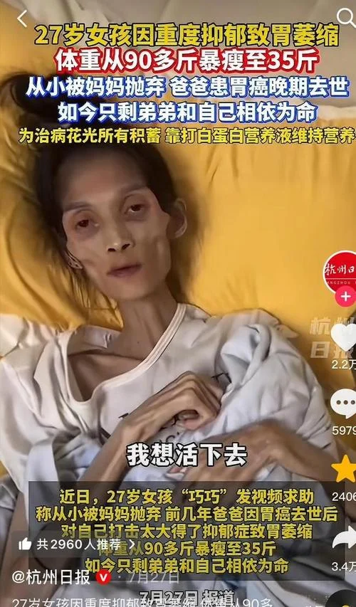 梦见病人瘦了-梦病人消瘦