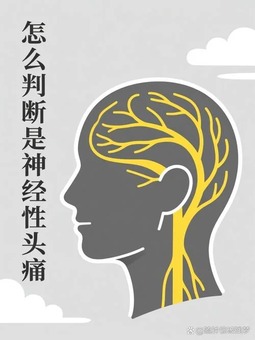 什么是神经性血管头痛_1