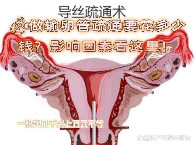 输卵管挤压术又叫什么_1
