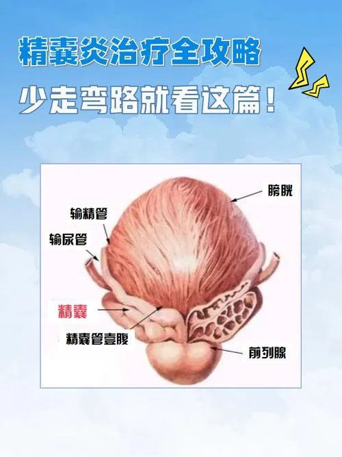 如何查输精管是否堵塞_1