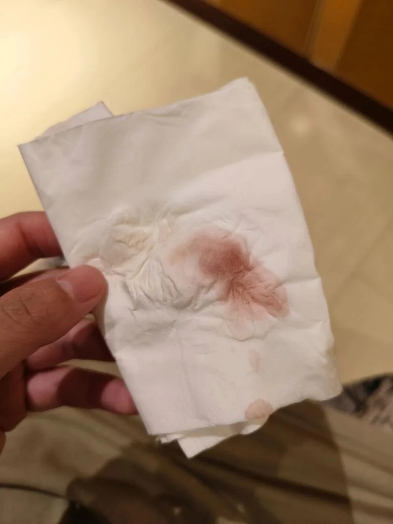 孕妇梦见自己内裤有血_2