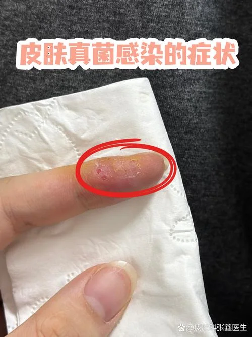 痒作者是谁写的_1