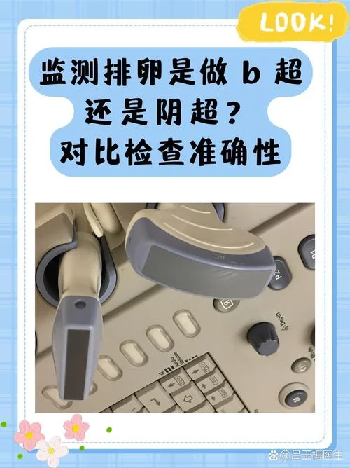 卵泡监测是干什么的_1