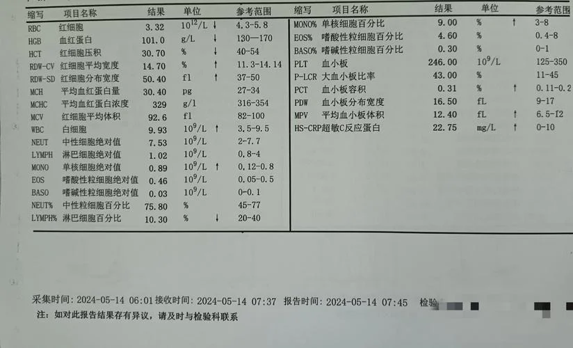 肺结核血液检查项目_1