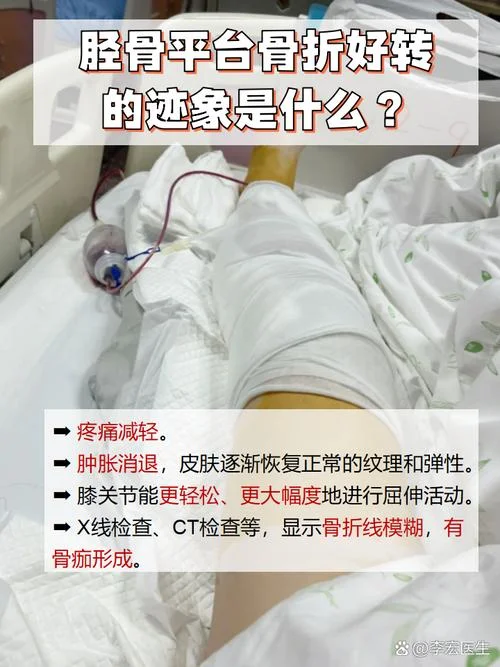 胫骨骨折体会和感悟_1