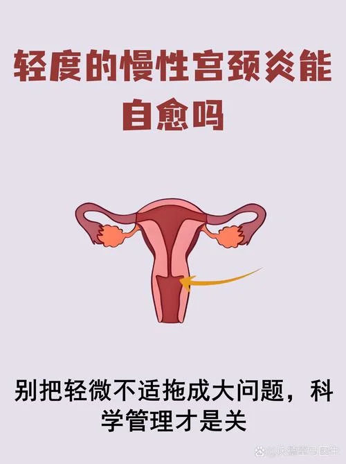 宫颈炎什么意思_2