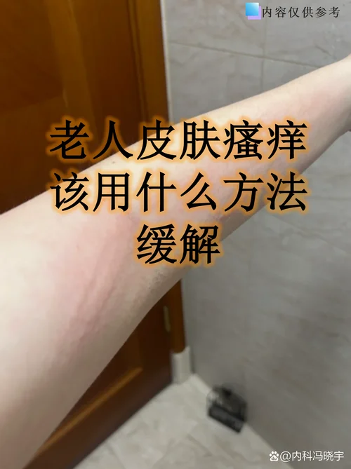 后背皮肤瘙痒怎么办-后背瘙痒怎么办