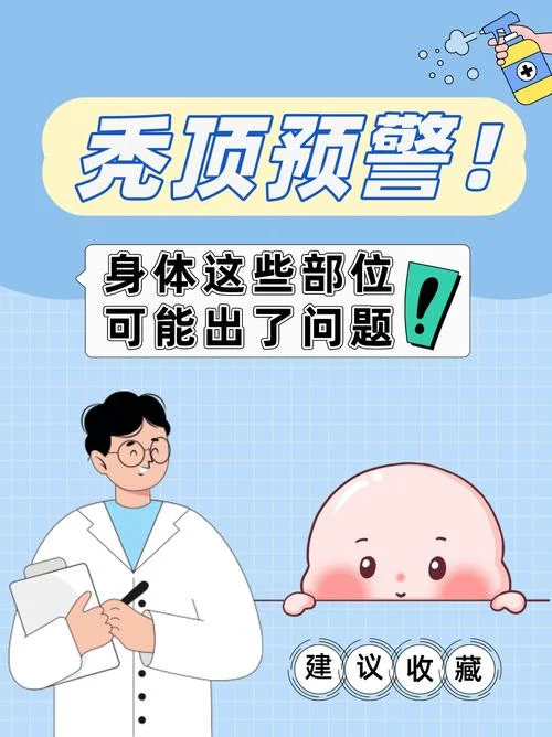 梦见自己秃顶了啥意思_2