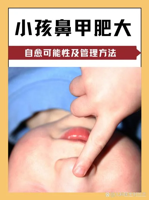 11岁鼻甲肥大怎么办-十岁鼻甲肥大怎么办