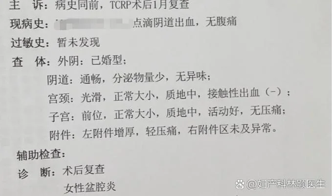 盆腔炎如何查-盆腔炎如何查