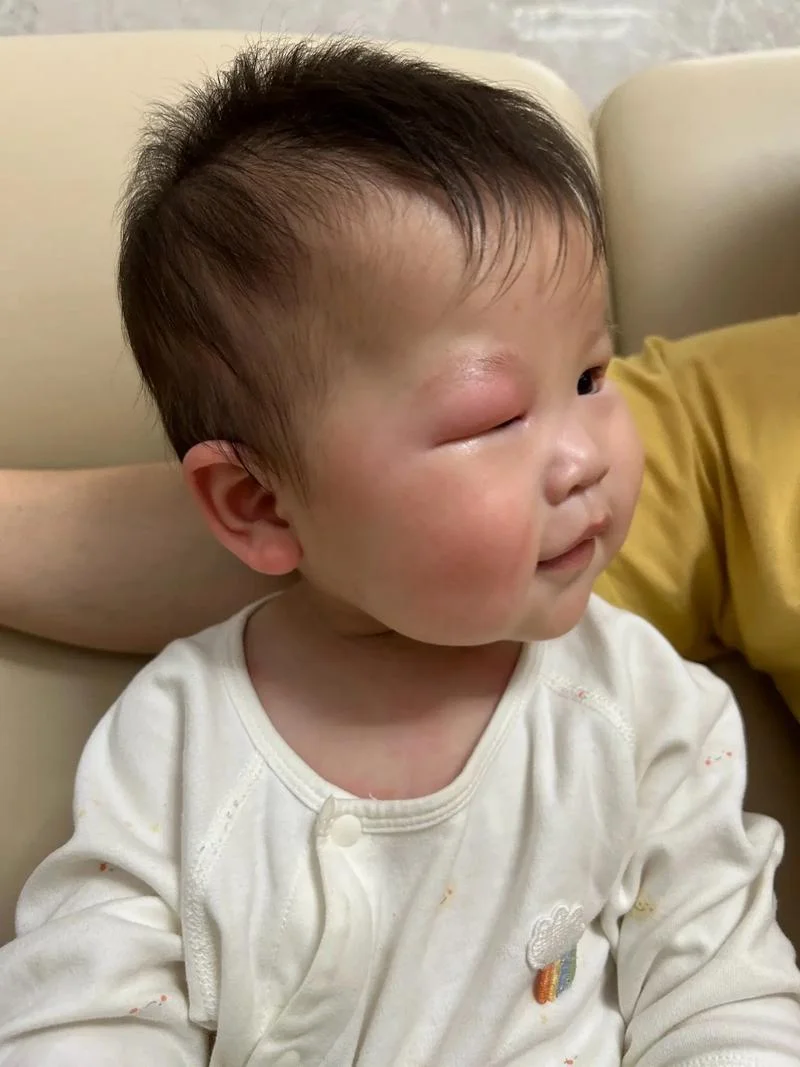 睡觉做梦睁不开眼_1