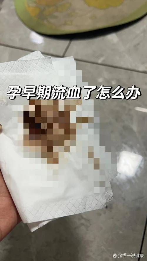 孕妇梦见大便和血-孕妇梦遗血便