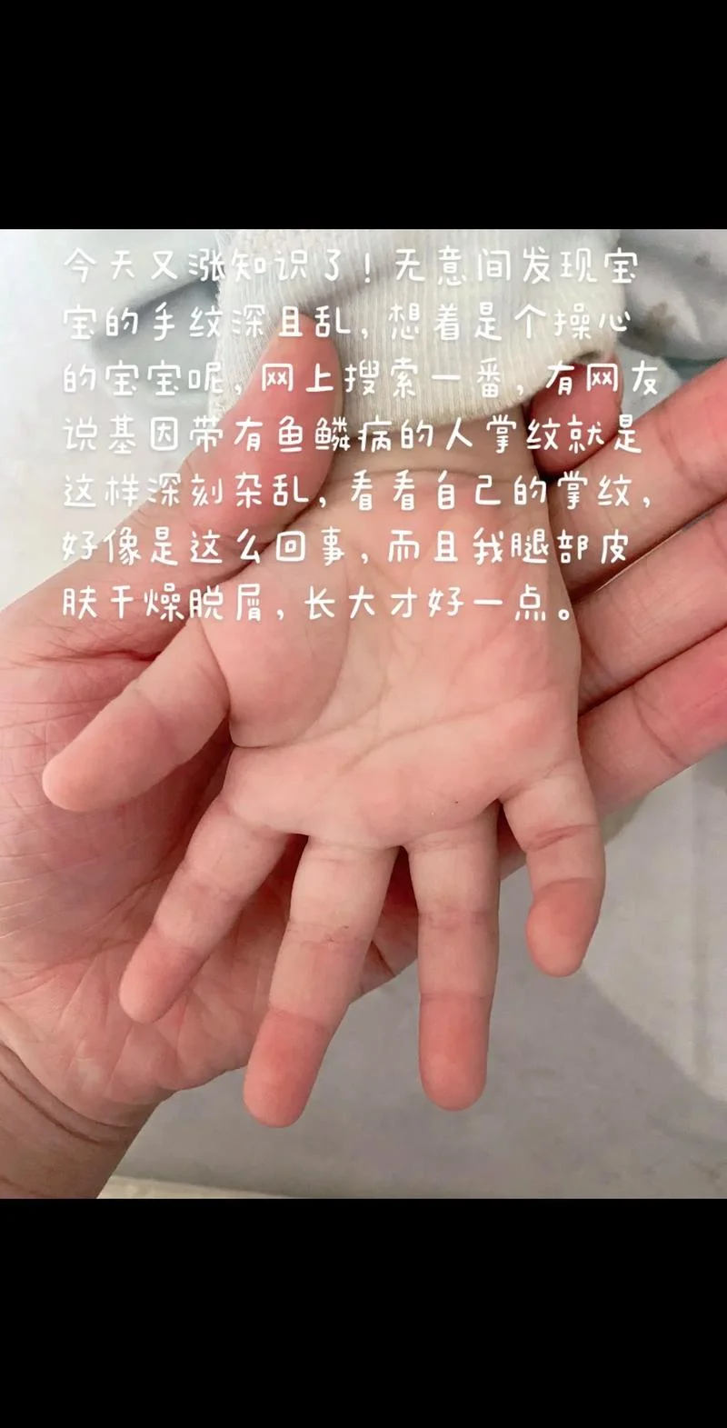 婴儿可以看手相吗_2