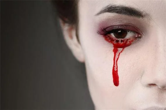 梦见男人打女人出血-梦见男打女流血