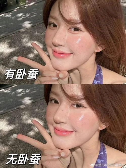 卧蚕变大的运势-卧蚕变大运势