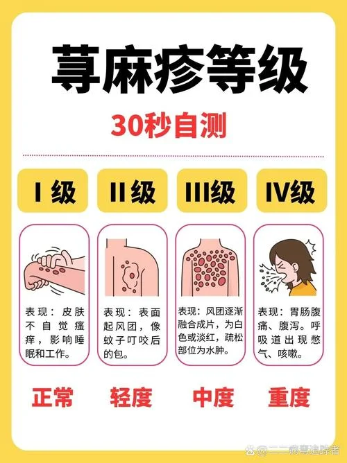 如何查自己过敏源是什么_1