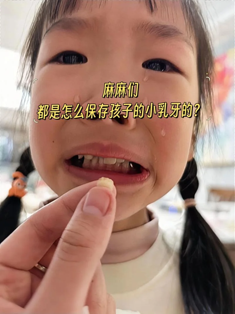 梦到小孩牙齿掉了-梦到小孩掉牙