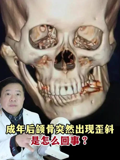 下巴歪面相-歪下巴显丑态