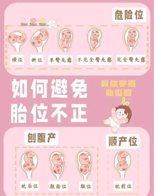 38周胎儿横位怎么办-38 周横位胎儿处理方案