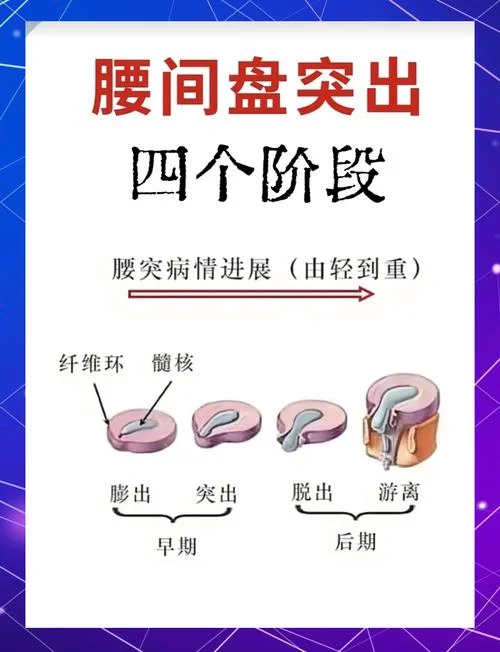 腰椎病变是指什么_2