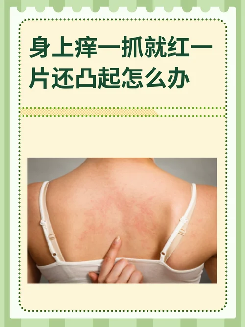皮肤痒了十几年怎么办_1