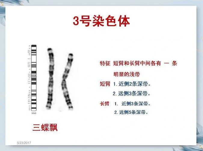 15号染色体三体是什么意思_1
