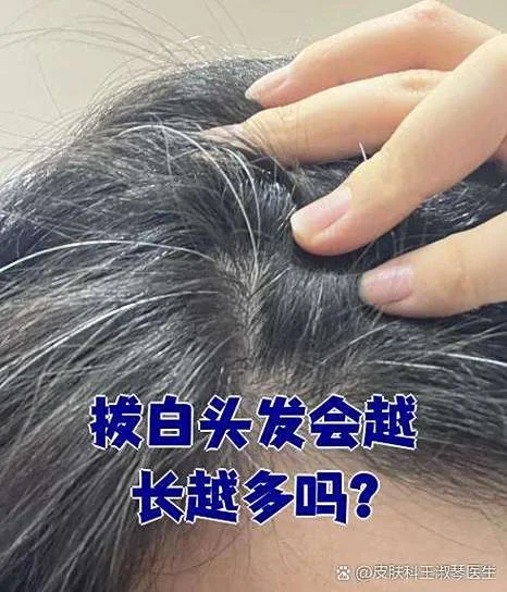 女人梦到拔孩子白头发_2