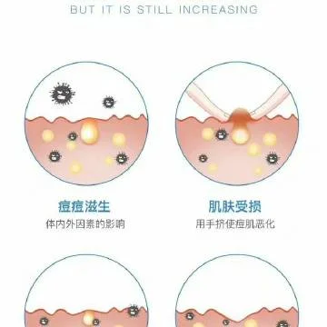 皮肤门诊需要什么条件_2
