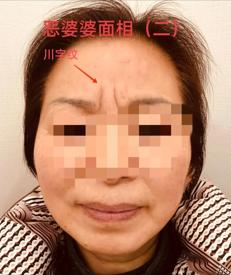 女人印堂有横纹面相_1