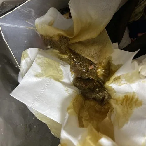 梦见自己呕吐大量东西_1