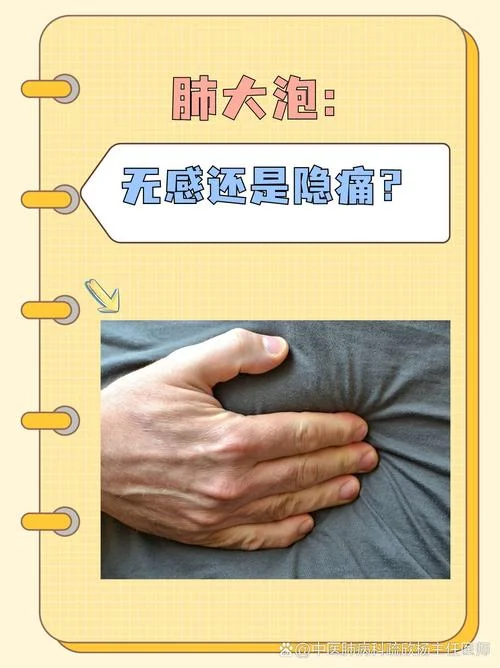 肺大泡一年内会长多大_1