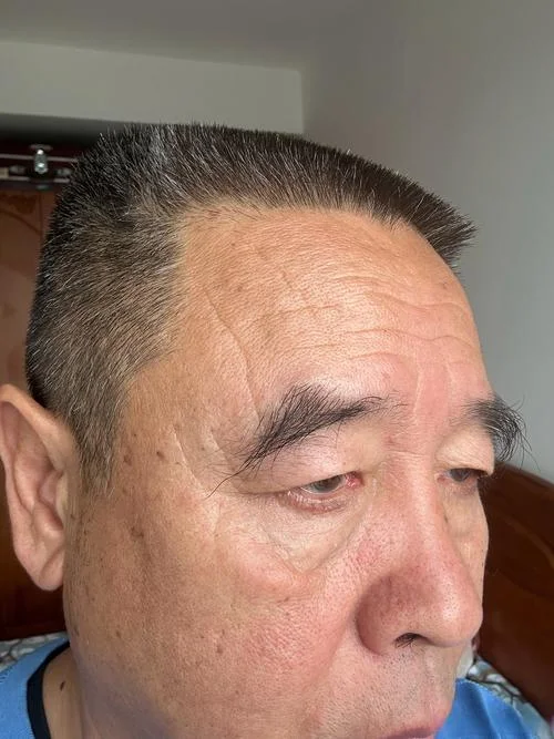 额头竖纹叫什么_2